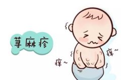 丘疹性荨麻疹有什么症状
