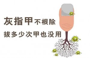 灰指甲的初期症状